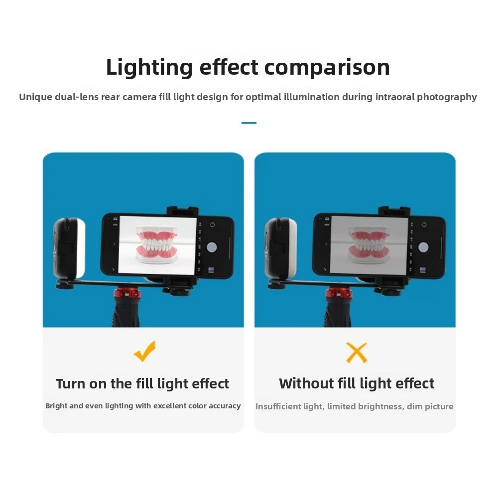 Diş Fotoğrafçılığı Işığı, Akıl - Lighting Gallery incelemesi ve fiyatı